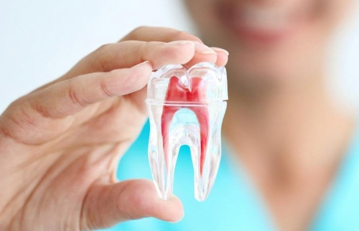 Root Canals in Naperville, IL